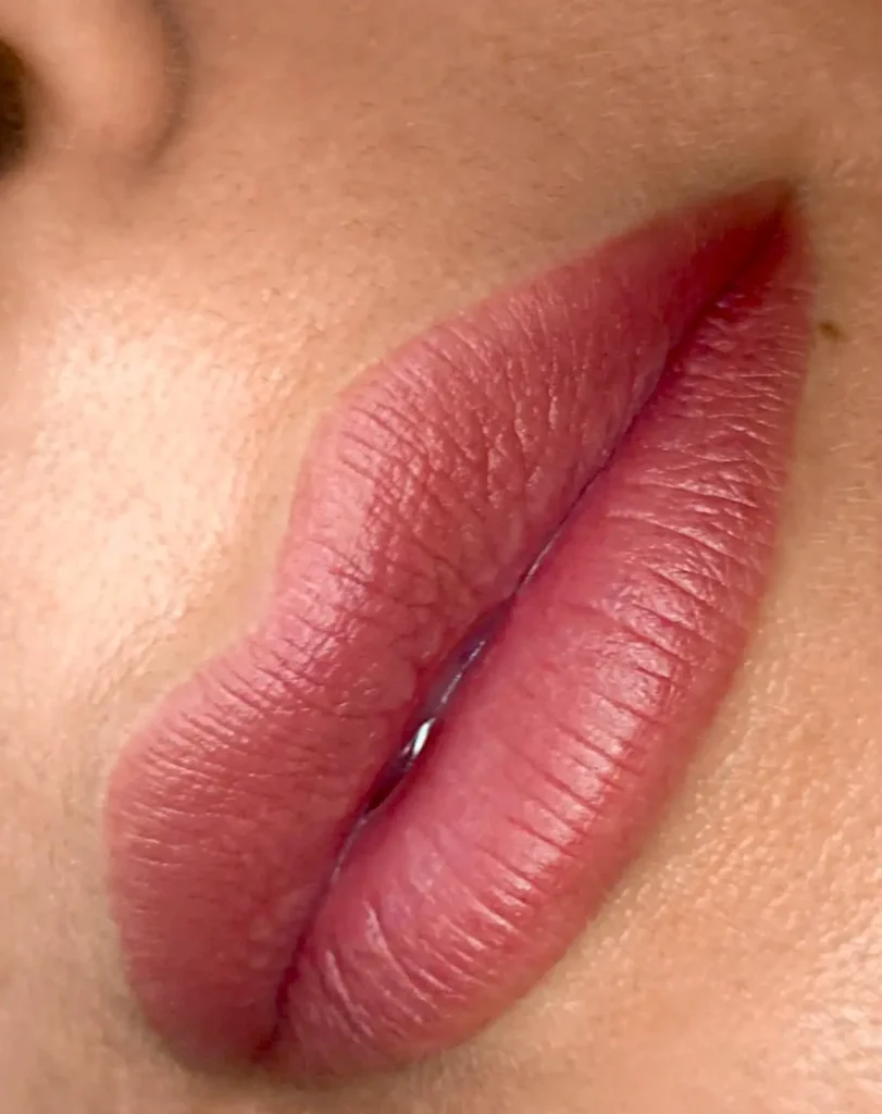 Lip neutralisation