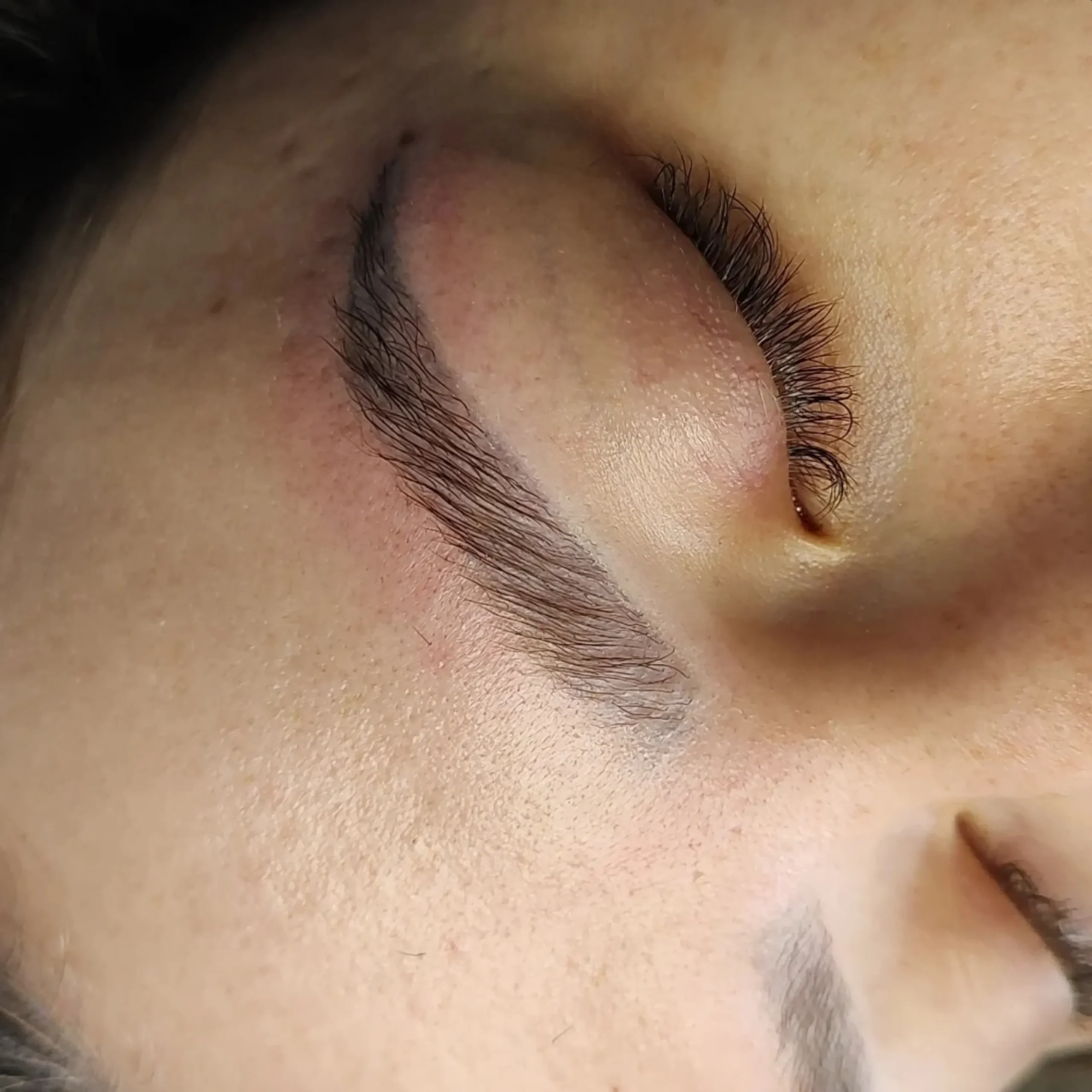 saline removal for eyebrow tattoo